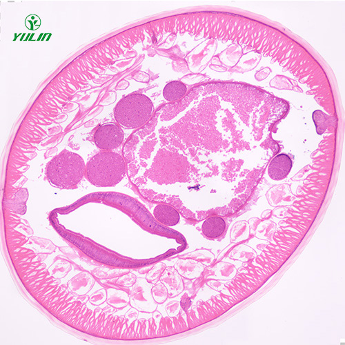 湖南蛔虫（雄）