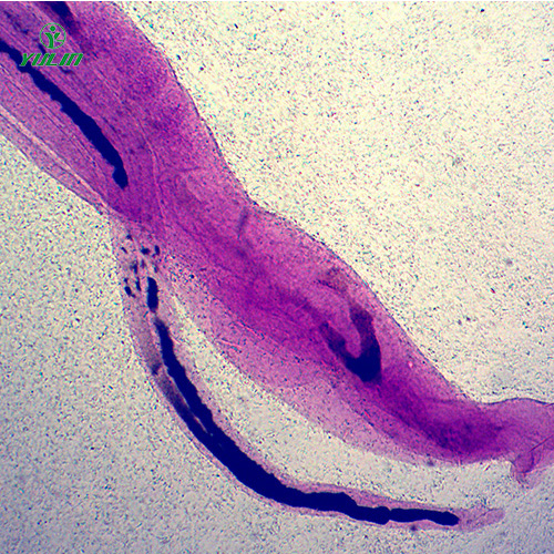 湖南日本血吸虫雌雄合抱装片