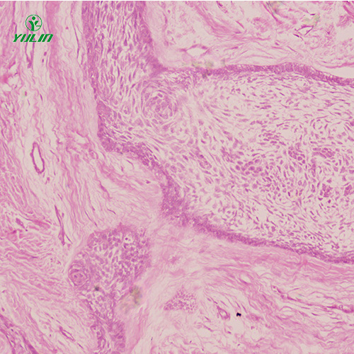 湖南人口腔病理标本片