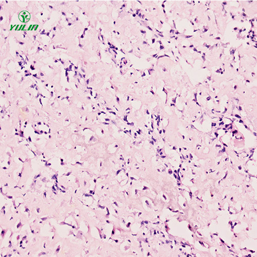 湖南人肌肉骨骼系统疾病标本片
