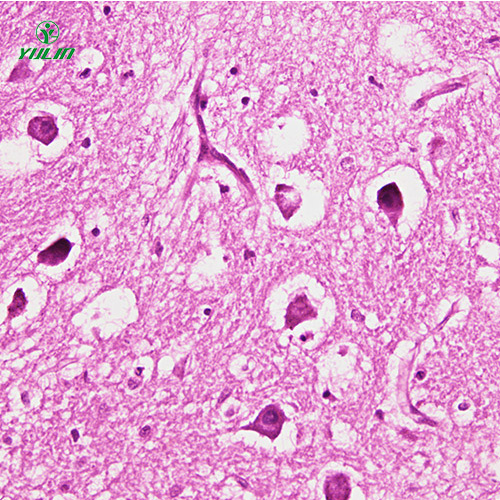湖南人神经系统疾病标本片