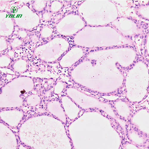 湖南人内分泌系统疾病标本片