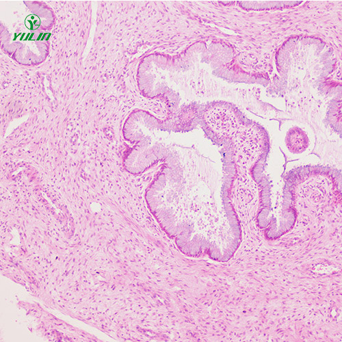 湖南人泌尿生殖系统疾病标本片