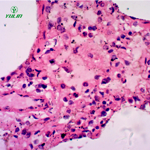 湖南人呼吸系统疾病标本片