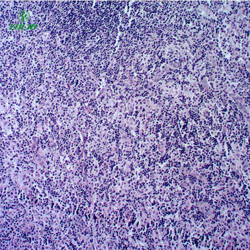 湖南人体免疫性疾病切片