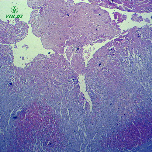 湖南人体局部血液循环障碍病理玻片