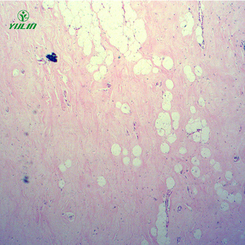 湖南人体细胞组织损伤病理切片