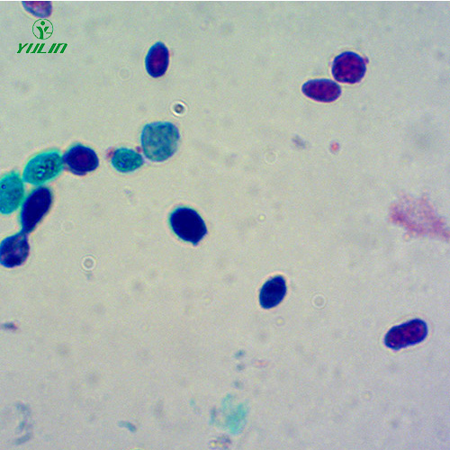 湖南酵母菌生物切片