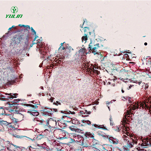 湖南水果病害标本片
