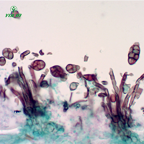 湖南茄科植物病害玻片