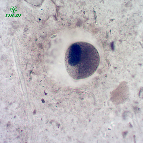 湖南医学寄生虫纤毛虫玻片
