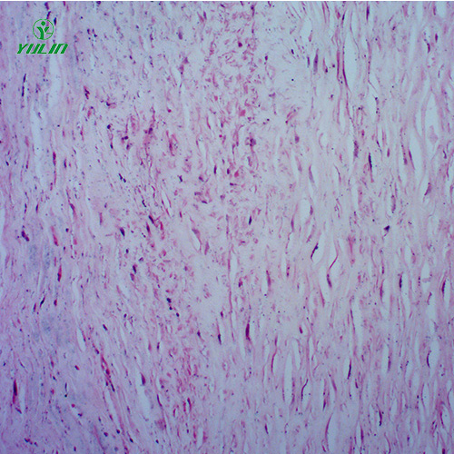湖南人体心血管及呼吸系统疾病玻璃玻片
