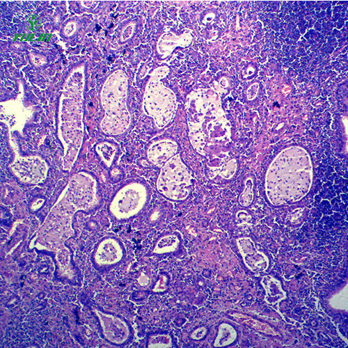 湖南炎症病理玻片